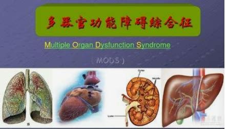 你有多壞 多重器官衰竭|多系统器官功能衰竭的原因是什么？需要注意哪些方。